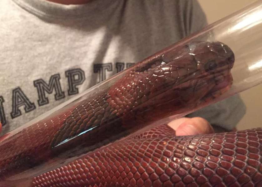 Ehlers-Danlos - Hình ảnh minh họa